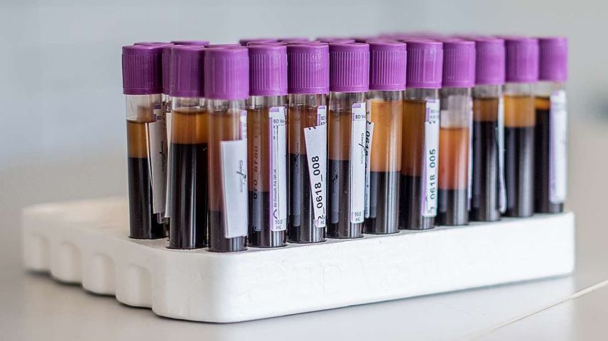 Die Blutproben aus dem Forschungsprogram Corona Immunitas sind bereit für die Analyse auf Antikörper. Foto: Corona Immunitas